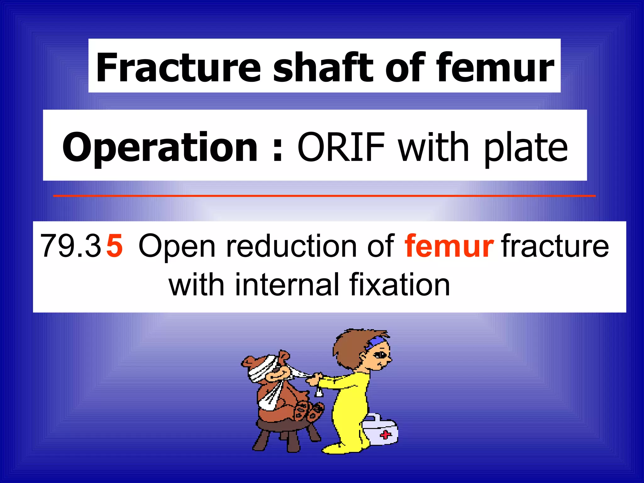 Fracture shaft of femur

 Operation : ORIF with plate

79.3 5 Open reduction of femur fracture
        with internal fixation
 