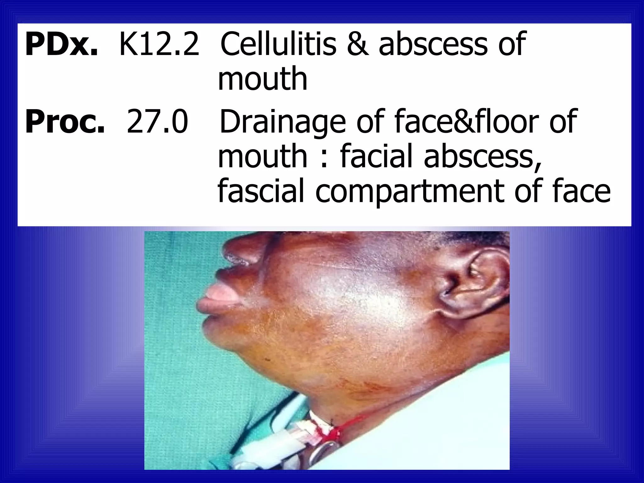 PDx. K12.2 Cellulitis & abscess of
           mouth
Proc. 27.0 Drainage of face&floor of
           mouth : facial abscess,
           fascial compartment of face
 