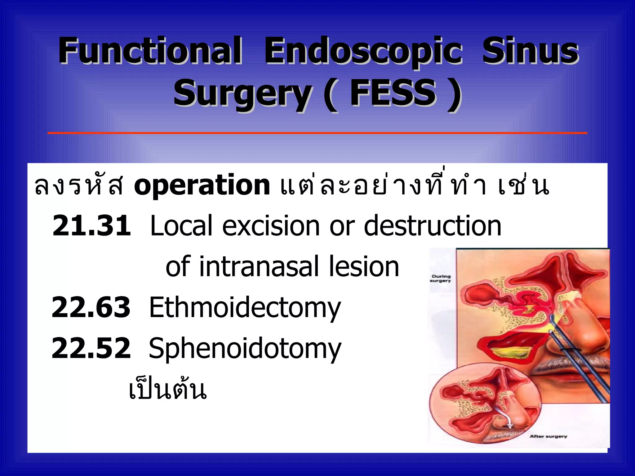 Functional Endoscopic Sinus
        Surgery ( FESS )

ลงรหั ส operation แต่ ล ะอย่ า งที ่ ท ำ า เช่ น
 21.31 Local excision or destruction
           of intranasal lesion
 22.63 Ethmoidectomy
 22.52 Sphenoidotomy
       เป็นต้น
 