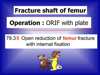Fracture shaft of femur

 Operation : ORIF with plate

79.3 5 Open reduction of femur fracture
        with internal fixation
 