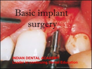 Basic implant surgery
Basic implant
surgery
INDIAN DENTAL ACADEMY
Leader in continuing Dental Education
www.indiandentalacademy.com
 