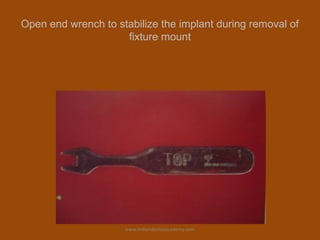 Open end wrench to stabilize the implant during removal of
fixture mount
www.indiandentalacademy.com
 