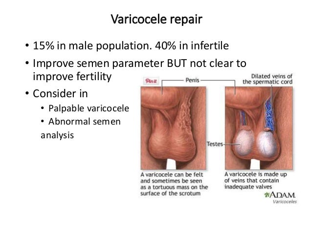 Real amateur first time sex video Chemo sperm infertile