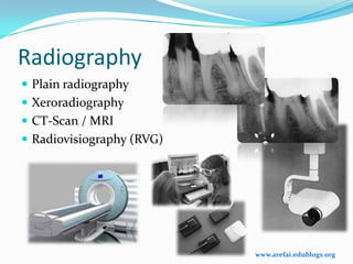 Radiography
 Plain radiography
 Xeroradiography
 CT-Scan / MRI
 Radiovisiography (RVG)




                           www.arefai.edublogs.org
 