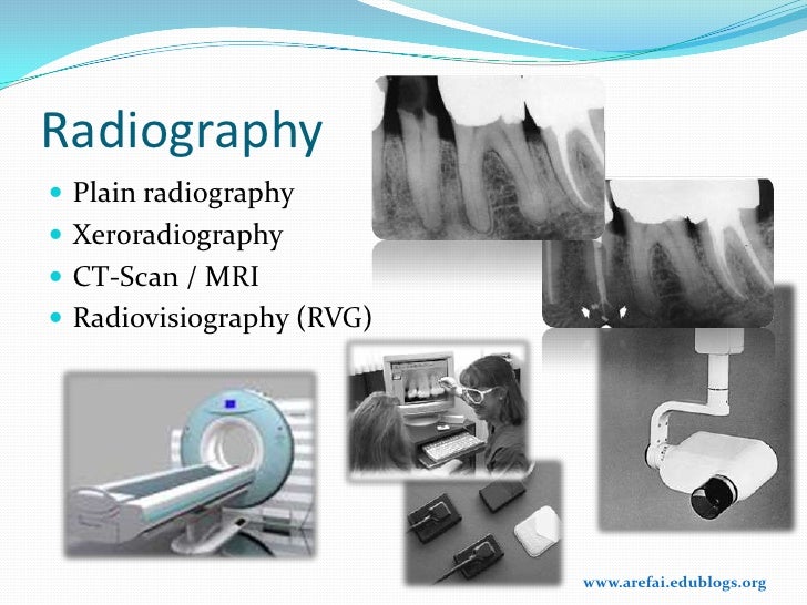 Basic Instruments Used In Endodontics