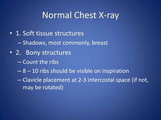 Normal Chest X-ray1. Soft tissue structuresShadows, most commonly, breast2.	Bony structuresCount the ribs8 – 10 ribs should be visible on inspirationClavicle placement at 2-3 intercostal space (if not, may be rotated)
