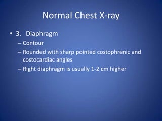 Normal Chest X-ray3.	DiaphragmContourRounded with sharp pointed costophrenic and costocardiac anglesRight diaphragm is usually 1-2 cm higher