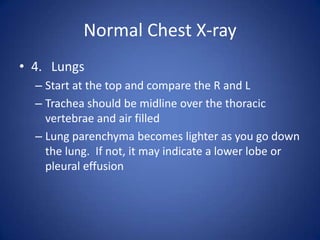 Normal Chest X-ray4.	LungsStart at the top and compare the R and LTrachea should be midline over the thoracic vertebrae and air filledLung parenchyma becomes lighter as you go down the lung.  If not, it may indicate a lower lobe or pleural effusion