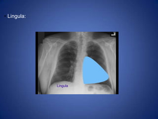 The airway is patent