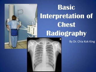 Basic Interpretation of Chest Radiography By Dr. ChiaKok King 