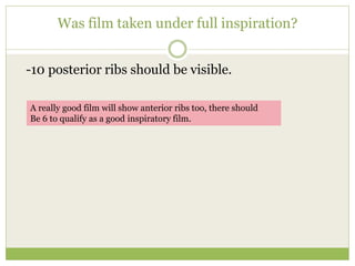 Was film taken under full inspiration?
-10 posterior ribs should be visible.
A really good film will show anterior ribs too, there should
Be 6 to qualify as a good inspiratory film.
 