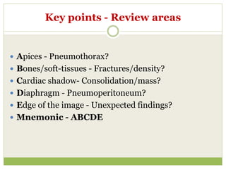 Key points - Review areas
 Apices - Pneumothorax?
 Bones/soft-tissues - Fractures/density?
 Cardiac shadow- Consolidation/mass?
 Diaphragm - Pneumoperitoneum?
 Edge of the image - Unexpected findings?
 Mnemonic - ABCDE
 