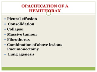 OPACIFICATION OF A
HEMITHORAX
 Pleural effusion
 Consolidation
 Collapse
 Massive tumour
 Fibrothorax
 Combination of above lesions
Pneumonectomy
 Lung agenesis
 