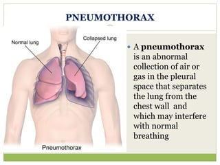 PNEUMOTHORAX
 A pneumothorax
is an abnormal
collection of air or
gas in the pleural
space that separates
the lung from the
chest wall and
which may interfere
with normal
breathing
 