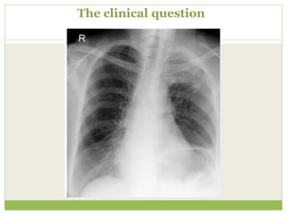 The clinical question
 