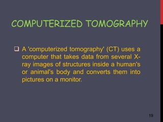 COMPUTERIZED TOMOGRAPHY
19
 A 'computerized tomography' (CT) uses a
computer that takes data from several X-
ray images of structures inside a human's
or animal's body and converts them into
pictures on a monitor.
 