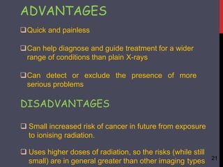 ADVANTAGES
Quick and painless
Can help diagnose and guide treatment for a wider
range of conditions than plain X-rays
Can detect or exclude the presence of more
serious problems
DISADVANTAGES
 Small increased risk of cancer in future from exposure
to ionising radiation.
 Uses higher doses of radiation, so the risks (while still
small) are in general greater than other imaging types 21
 