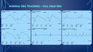 Introduction to Clinical Electroretinography | PDF