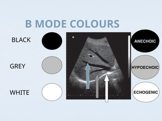 Basic Introduction to Ultrasound mahmood ibrahimi.PPT