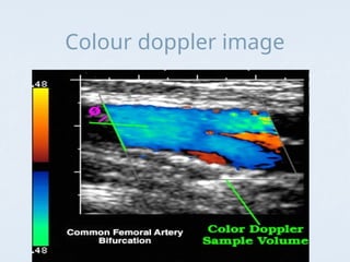 Basic Introduction to Ultrasound mahmood ibrahimi.PPT