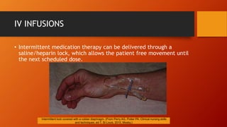 IV INFUSIONS
• Intermittent medication therapy can be delivered through a
saline/heparin lock, which allows the patient free movement until
the next scheduled dose.
Intermittent lock covered with a rubber diaphragm. (From Perry AG, Potter PA: Clinical nursing skills
and techniques, ed 7, St Louis, 2010, Mosby.)
 