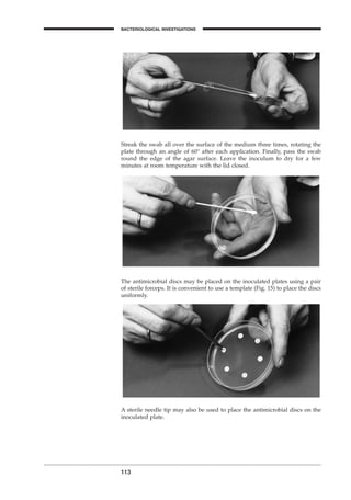 113
BACTERIOLOGICAL INVESTIGATIONS
A
Streak the swab all over the surface of the medium three times, rotating the
plate through an angle of 60∞ after each application. Finally, pass the swab
round the edge of the agar surface. Leave the inoculum to dry for a few
minutes at room temperature with the lid closed.
The antimicrobial discs may be placed on the inoculated plates using a pair
of sterile forceps. It is convenient to use a template (Fig. 15) to place the discs
uniformly.
A sterile needle tip may also be used to place the antimicrobial discs on the
inoculated plate.
BLM1 1/17/04 2:02 PM Page 113
 