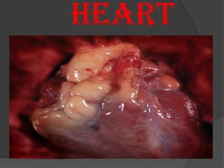 HEART
 