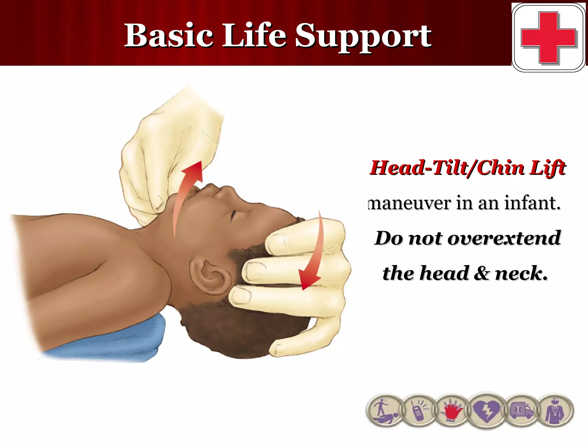 Basic life support | PPT