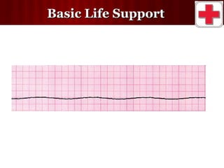 Basic life support | PPT