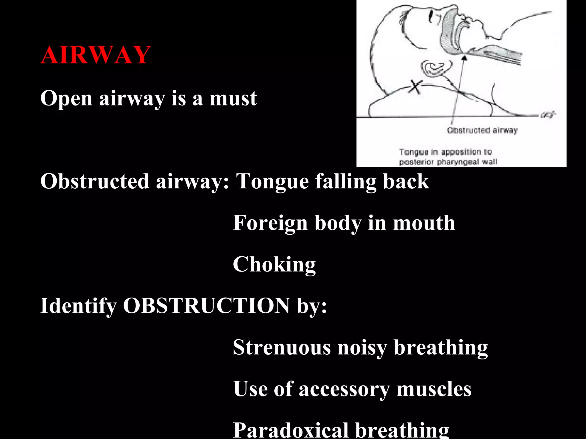 AIRWAY 
Open airway is a must 
Obstructed airway: Tongue falling back 
Foreign body in mouth 
Choking 
Identify OBSTRUCTION by: 
Strenuous noisy breathing 
Use of accessory muscles 
Paradoxical breathing 
 