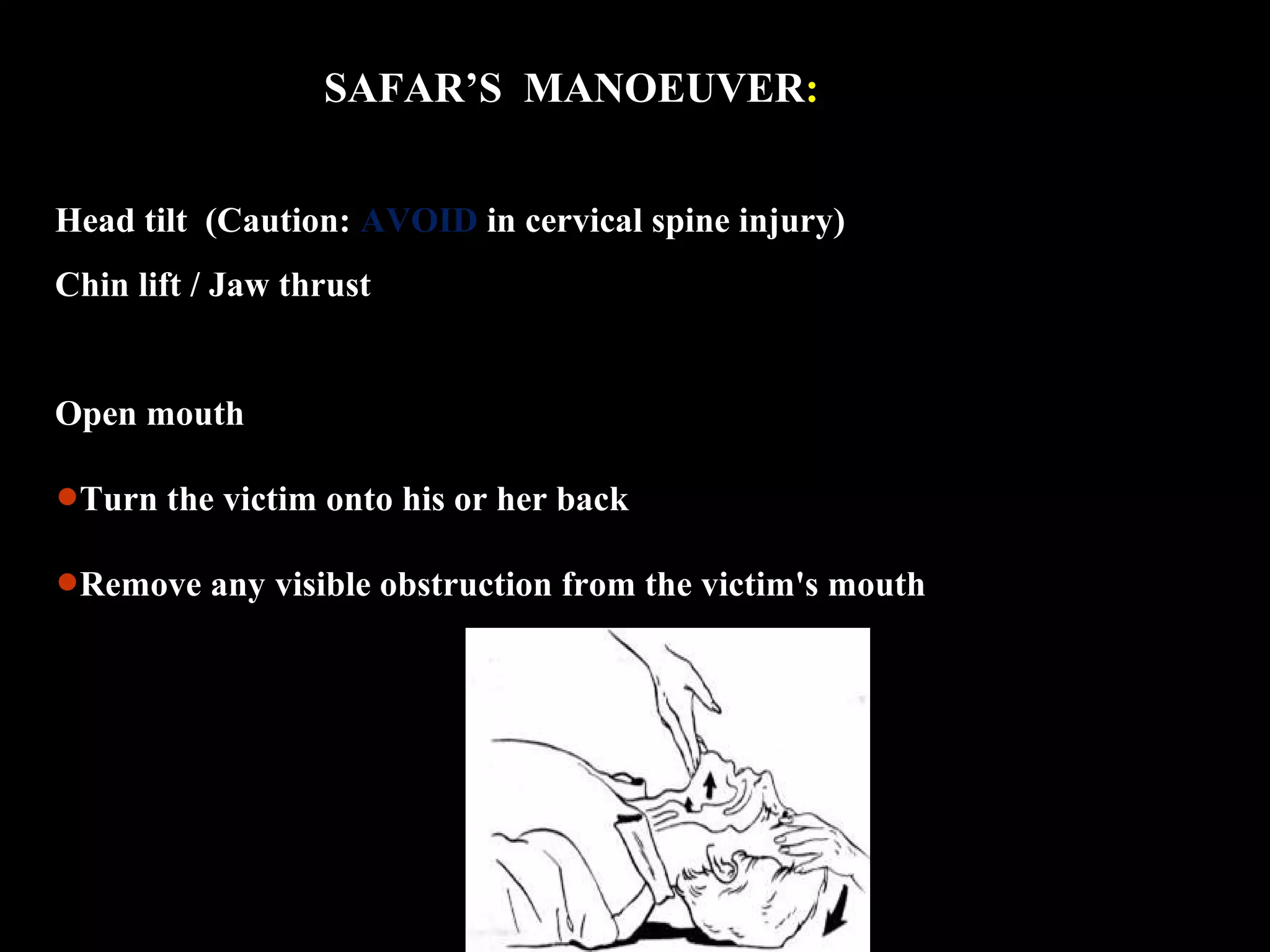 SAFAR’S MANOEUVER: 
Head tilt (Caution: AVOID in cervical spine injury) 
Chin lift / Jaw thrust 
Open mouth 
•Turn the victim onto his or her back 
•Remove any visible obstruction from the victim's mouth 
 