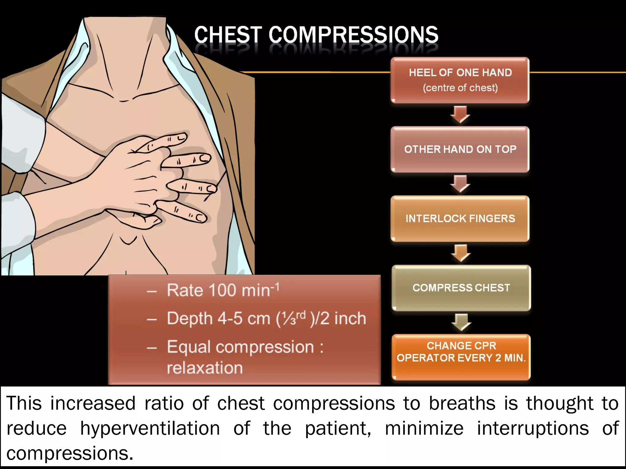 This increased ratio of chest compressions to breaths is thought to 
reduce hyperventilation of the patient, minimize interruptions of 
compressions. 
 