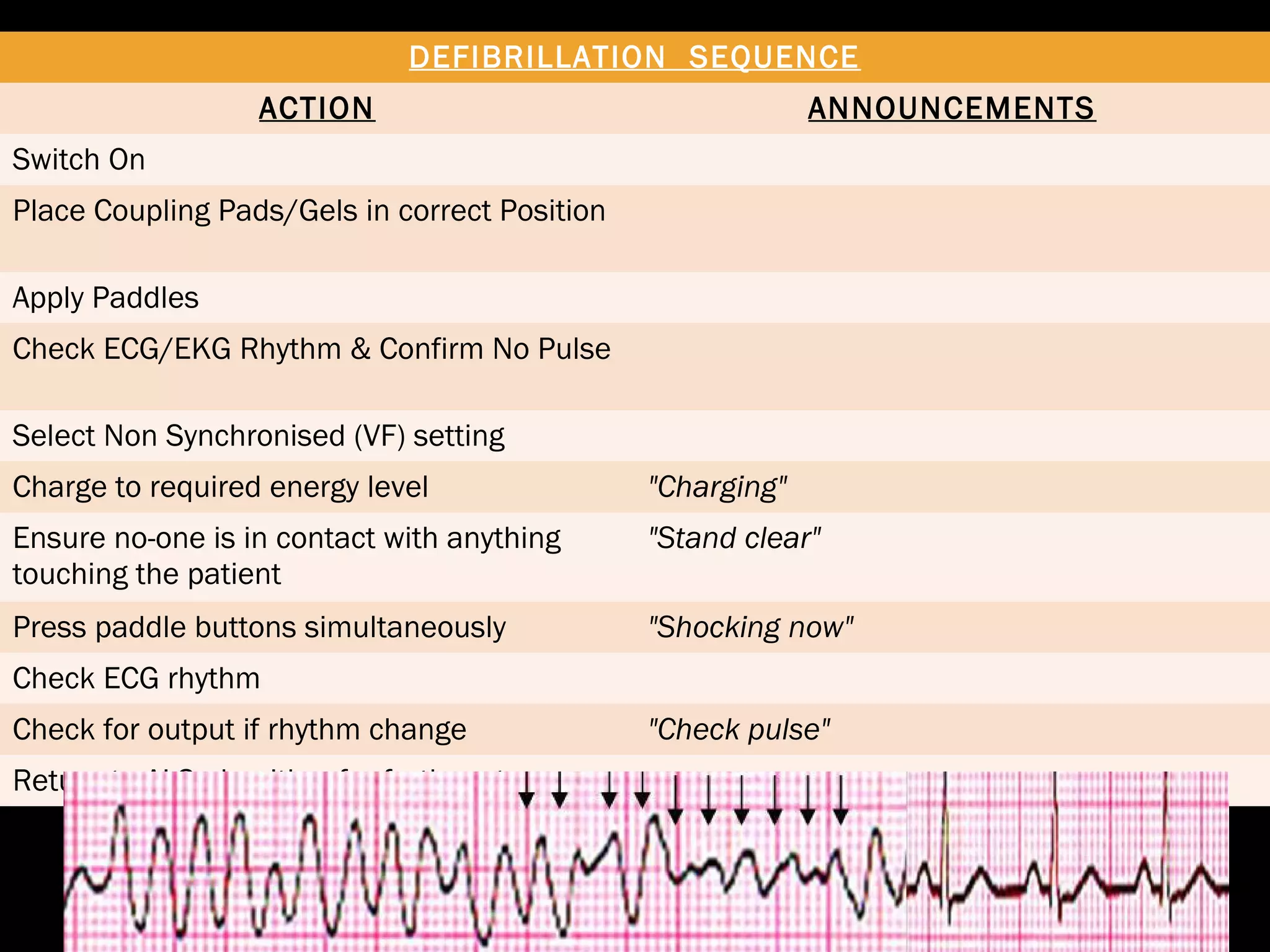 DEFIBRILLATION SEQUENCE 
ACTION ANNOUNCEMENTS 
Switch On 
Place Coupling Pads/Gels in correct Position 
Apply Paddles 
Check ECG/EKG Rhythm & Confirm No Pulse 
Select Non Synchronised (VF) setting 
Charge to required energy level "Charging" 
Ensure no-one is in contact with anything 
touching the patient 
"Stand clear" 
Press paddle buttons simultaneously "Shocking now" 
Check ECG rhythm 
Check for output if rhythm change "Check pulse" 
Return to ALS algorithm for further steps 
 