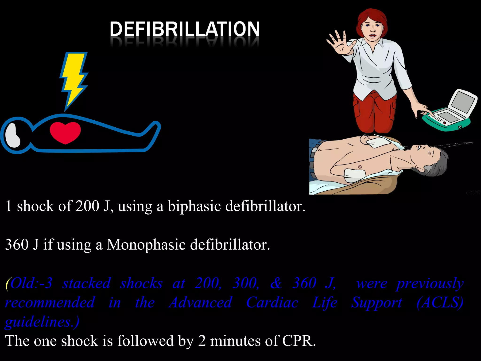 1 shock of 200 J, using a biphasic defibrillator. 
360 J if using a Monophasic defibrillator. 
(Old:-3 stacked shocks at 200, 300, & 360 J, were previously 
recommended in the Advanced Cardiac Life Support (ACLS) 
guidelines.) 
The one shock is followed by 2 minutes of CPR. 
 
