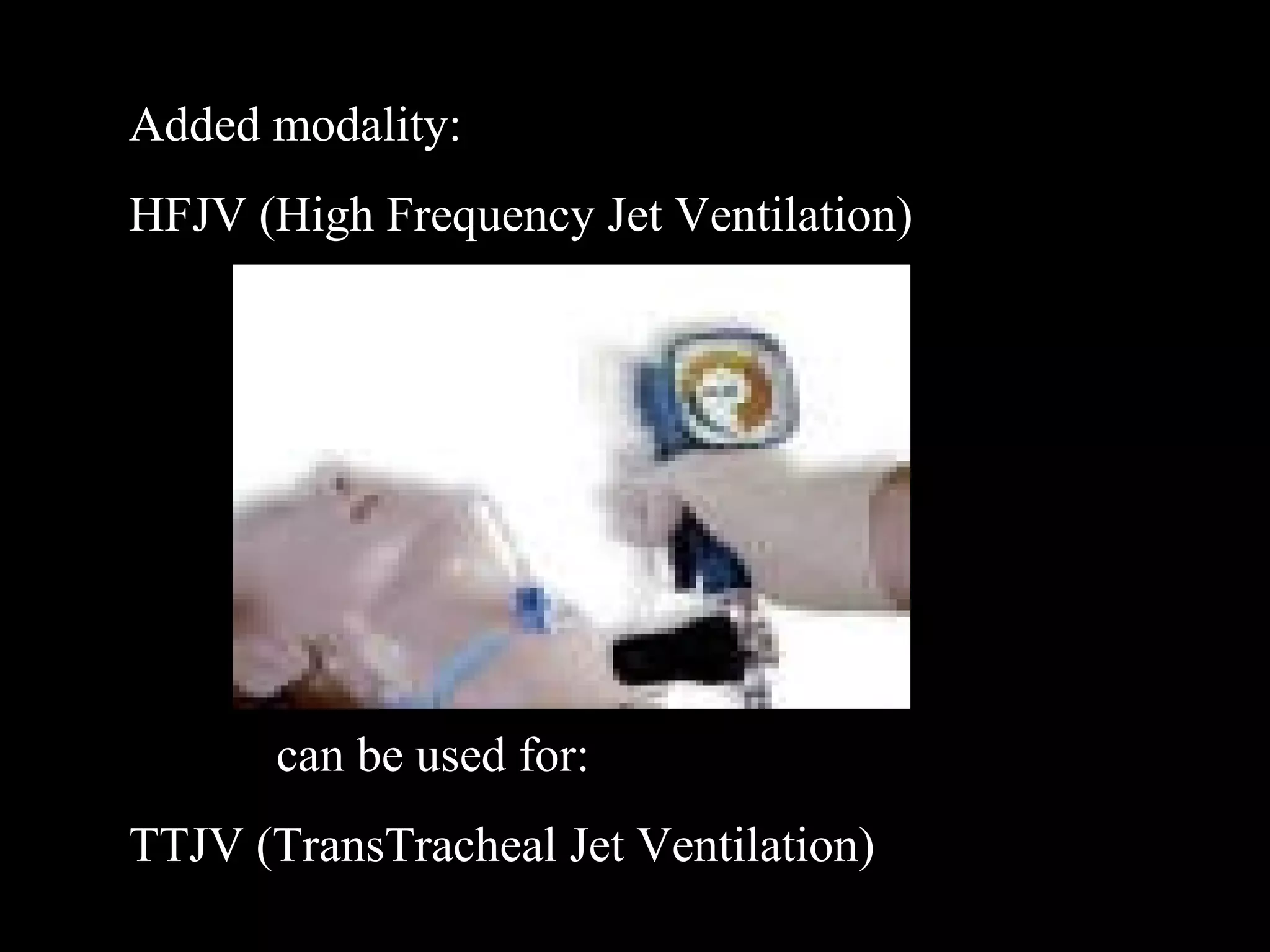 Added modality: 
HFJV (High Frequency Jet Ventilation) 
can be used for: 
TTJV (TransTracheal Jet Ventilation) 
 