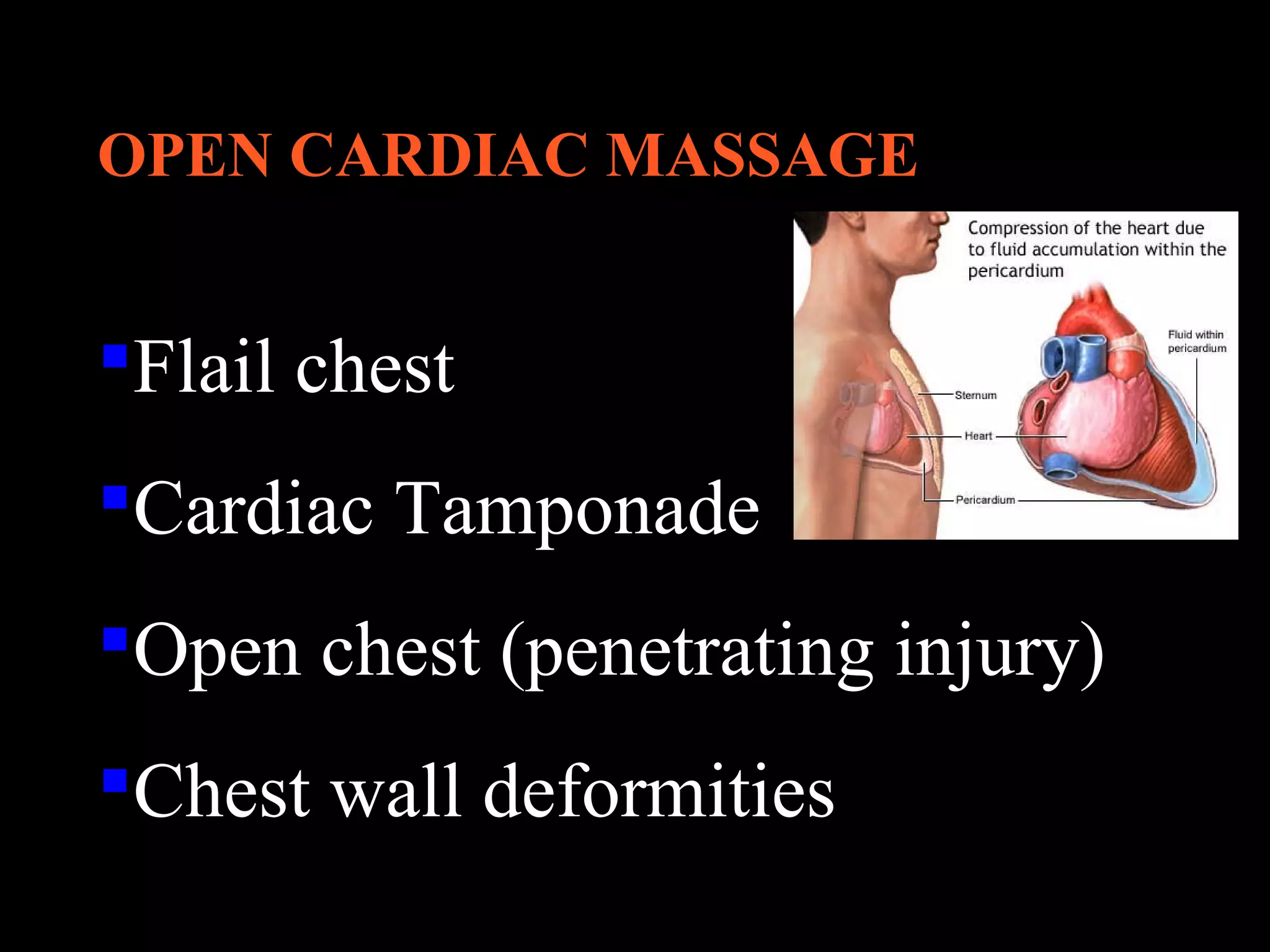OPEN CARDIAC MASSAGE 
Flail chest 
Cardiac Tamponade 
Open chest (penetrating injury) 
Chest wall deformities 
 