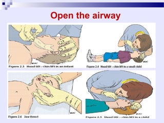 Basic life support | PPT
