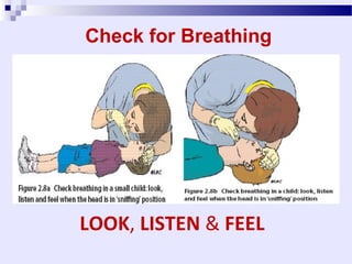 Complications of CPR
1. Most common: Rib fractures & sternal
fracture.
2. Pneumothorax
3. Bleeding: Hemopericardium, hemothorax
& anterior mediastinal bleeding.
4. Contusion of: Heart & Lung.
5. Lacerations of: Liver & Spleen.
 