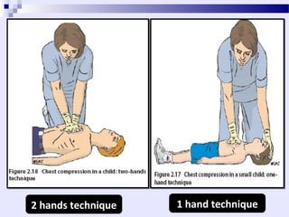 Two Hand Method Basic Life Support, Bit by Bit approach | PPT