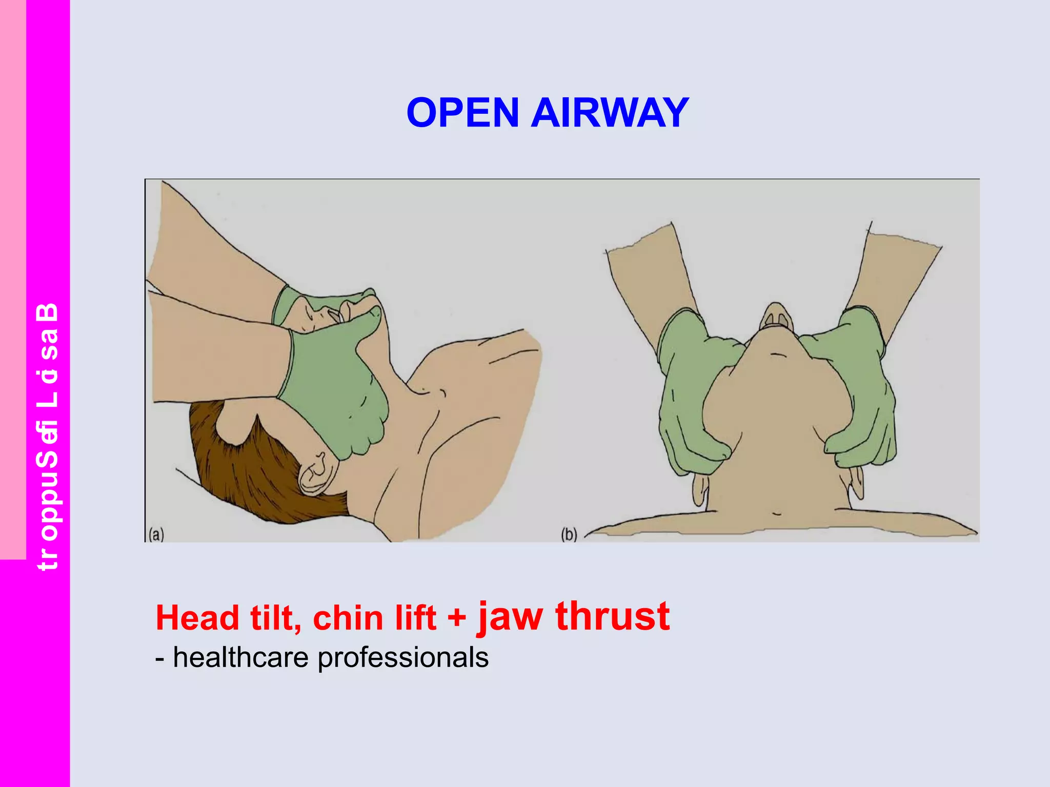 BasicLifeSupport
OPEN AIRWAY
Head tilt, chin lift + jaw thrust
- healthcare professionals
 