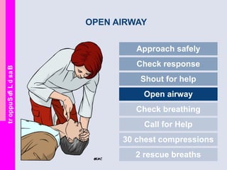 BasicLifeSupport
OPEN AIRWAY
Approach safely
Check response
Shout for help
Open airway
Check breathing
Call for Help
30 chest compressions
2 rescue breaths
 