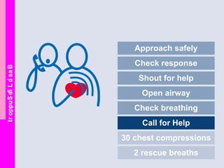 BasicLifeSupport
Approach safely
Check response
Shout for help
Open airway
Check breathing
Call for Help
30 chest compressions
2 rescue breaths
 