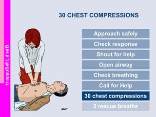 BasicLifeSupport
30 CHEST COMPRESSIONS
Approach safely
Check response
Shout for help
Open airway
Check breathing
Call for Help
30 chest compressions
2 rescue breaths
 