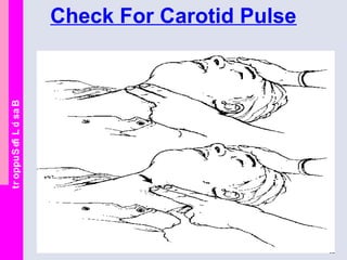 BasicLifeSupport Check For Carotid Pulse
 