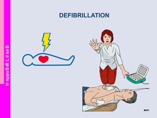 BasicLifeSupport
DEFIBRILLATION
 