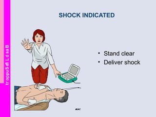BasicLifeSupport
SHOCK INDICATED
• Stand clear
• Deliver shock
 