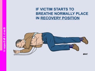 BasicLifeSupport
IF VICTIM STARTS TO
BREATHE NORMALLY PLACE
IN RECOVERY POSITION
 
