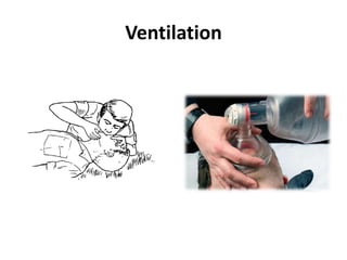 Ventilation
 