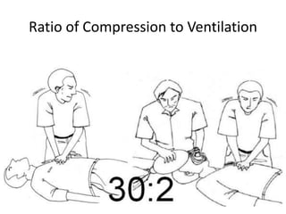 Ratio of Compression to Ventilation
 