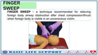 FINGER SWEEP - a technique recommended for relieving
foreign body airway obstruction after chest compression/thrust
when foreign body is visible in an unconscious victim.
 